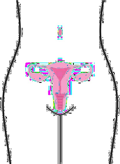 Klinik çalışma tasarımının şeması